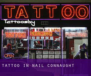 Tattoo in Nail (Connaught)